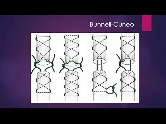 Bunnell-Cuneo