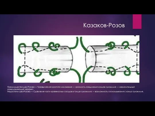 Казаков-Розов Преимущества шва Розова — Чрезвычайная простота наложения; — прочность соединения концов