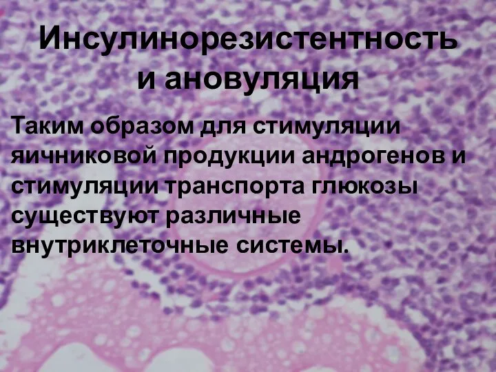 Инсулинорезистентность и ановуляция Таким образом для стимуляции яичниковой продукции андрогенов и стимуляции