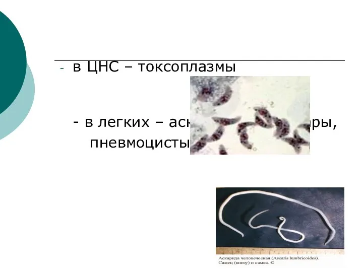 в ЦНС – токсоплазмы - в легких – аскариды, токсокары, пневмоцисты и т.д.