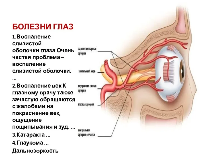 БОЛЕЗНИ ГЛАЗ 1.Воспаление слизистой оболочки глаза Очень частая проблема – воспаление слизистой