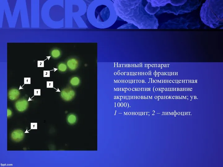 Нативный препарат обогащенной фракции моноцитов. Люминесцентная микроскопия (окрашивание акридиновым оранжевым; ув. 1000).