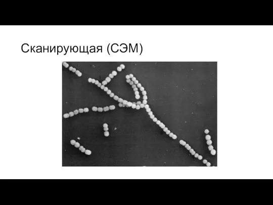 Сканирующая (СЭМ)