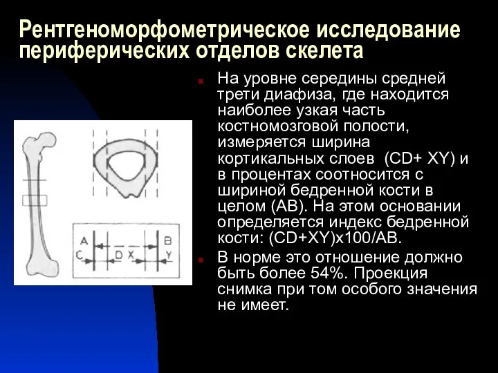 Рентгеноморфометрическое исследование периферических отделов скелета На уровне середины средней трети диафиза, где