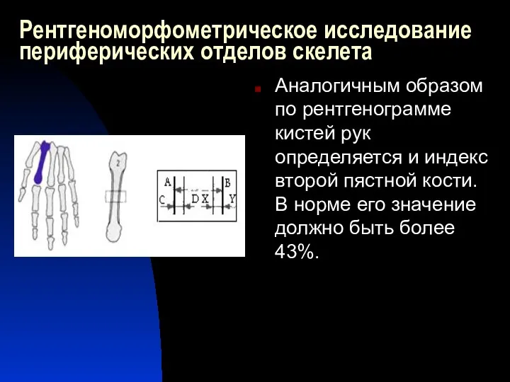 Рентгеноморфометрическое исследование периферических отделов скелета Аналогичным образом по рентгенограмме кистей рук определяется