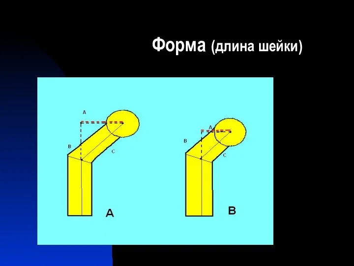 Форма (длина шейки)