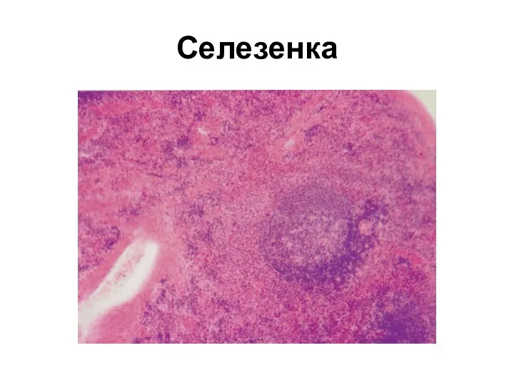 Селезенка