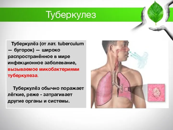 Туберкулез Туберкулёз (от лат. tuberculum — бугорок) — широко распространённое в мире