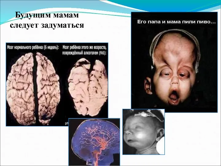 Будущим мамам следует задуматься