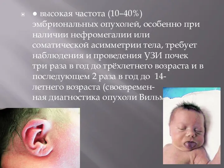 ● высокая частота (10–40%) эмбриональных опухолей, особенно при наличии нефромегалии или соматической