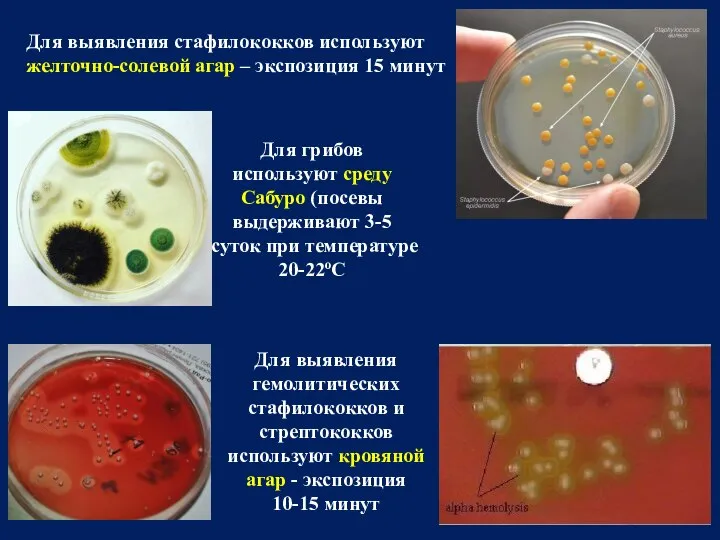 Для выявления стафилококков используют желточно-солевой агар – экспозиция 15 минут Для выявления