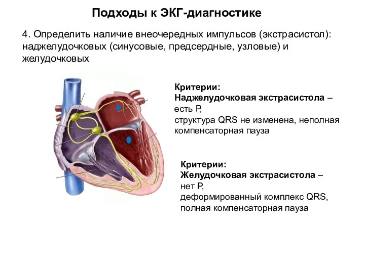 Подходы к ЭКГ-диагностике 4. Определить наличие внеочередных импульсов (экстрасистол): наджелудочковых (синусовые, предсердные,