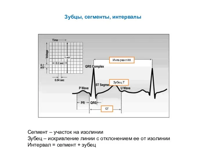 Интервал RR QT Зубец Т Зубцы, сегменты, интервалы Сегмент – участок на