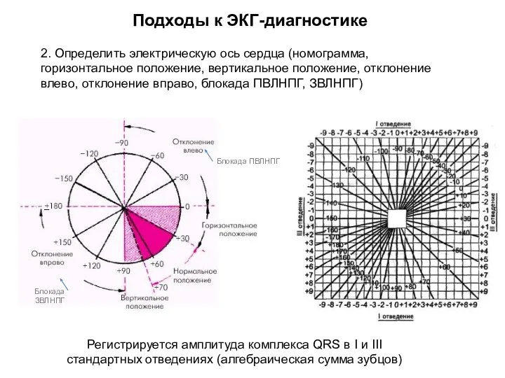 Подходы к ЭКГ-диагностике 2. Определить электрическую ось сердца (номограмма, горизонтальное положение, вертикальное