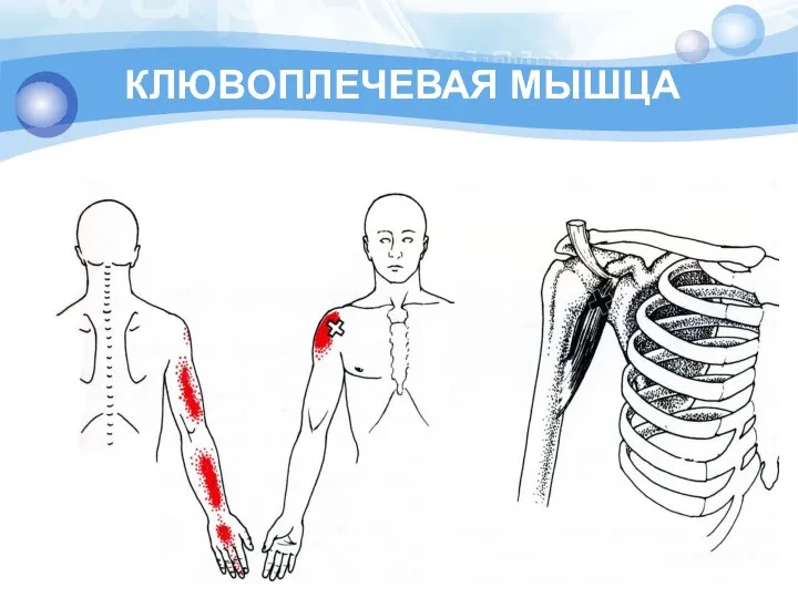 КЛЮВОПЛЕЧЕВАЯ МЫШЦА