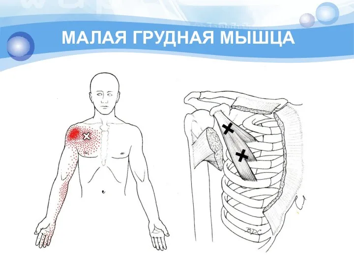 МАЛАЯ ГРУДНАЯ МЫШЦА