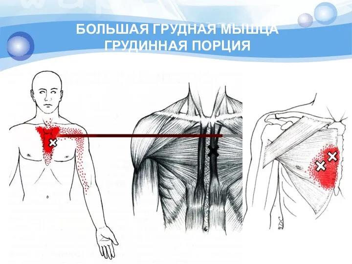 БОЛЬШАЯ ГРУДНАЯ МЫШЦА ГРУДИННАЯ ПОРЦИЯ