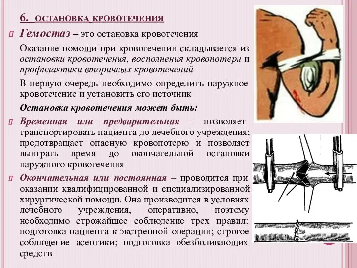 6. остановка кровотечения Гемостаз – это остановка кровотечения Оказание помощи при кровотечении