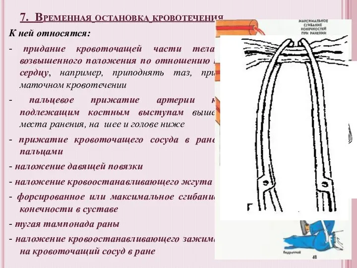 7. Временная остановка кровотечения К ней относятся: - придание кровоточащей части тела