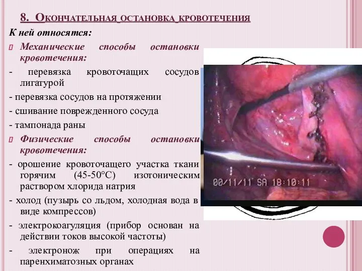 8. Окончательная остановка кровотечения К ней относятся: Механические способы остановки кровотечения: -