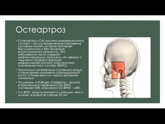 Остеартроз Остеоартроз (ОА) височно-нижнечелюстного сустава – это дистрофическое поражение суставных тканей, которое