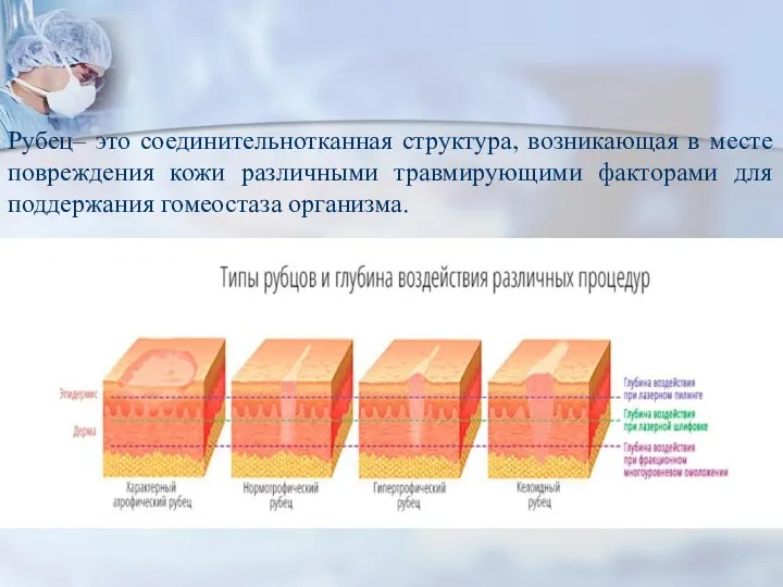 Рубец– это соединительнотканная структура, возникающая в месте повреждения кожи различными травмирующими факторами для поддержания гомеостаза организма.