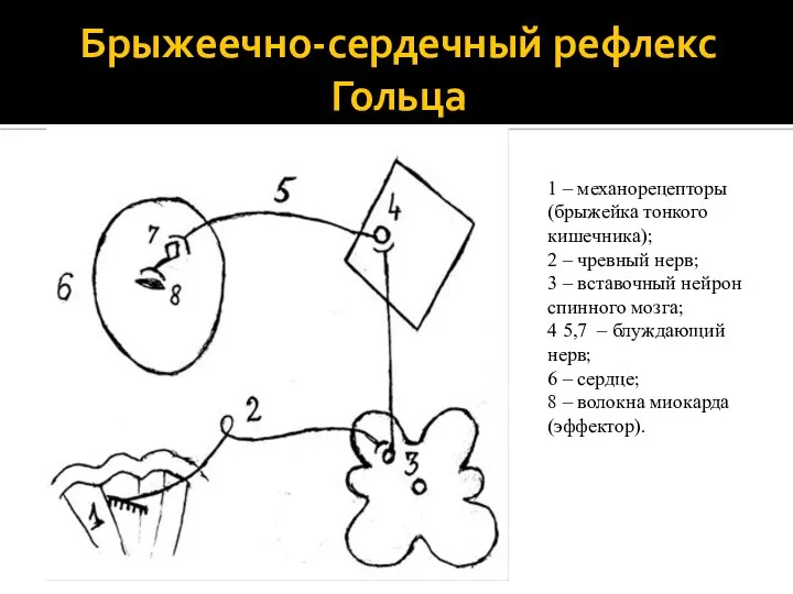 Брыжеечно-сердечный рефлекс Гольца 1 – механорецепторы (брыжейка тонкого кишечника); 2 – чревный