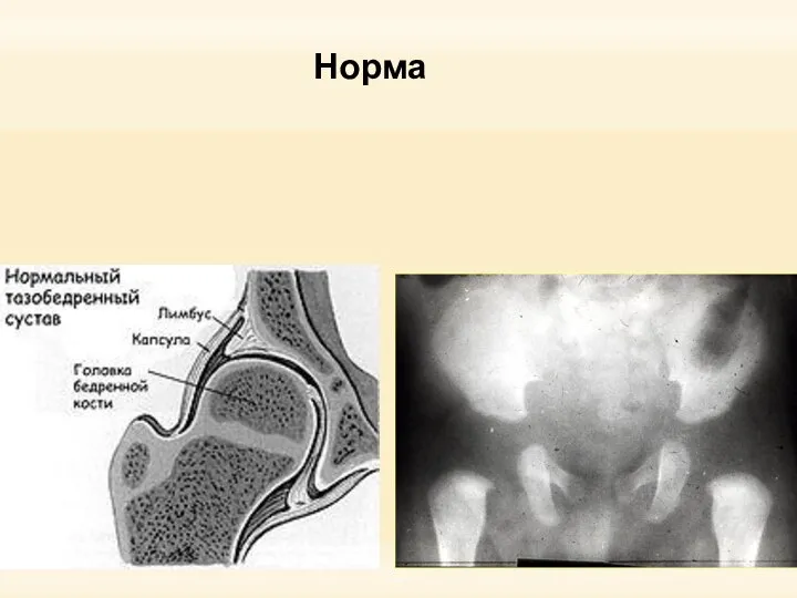 Норма