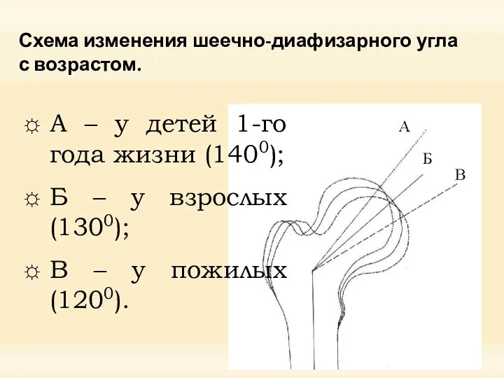 Схема изменения шеечно-диафизарного угла с возрастом. А – у детей 1-го года