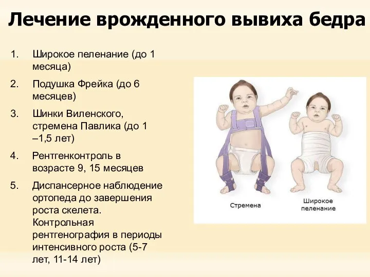 Лечение врожденного вывиха бедра Широкое пеленание (до 1 месяца) Подушка Фрейка (до