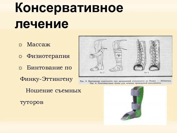 Консервативное лечение Массаж Физиотерапия Бинтование по Финку-Эттингену Ношение съемных туторов