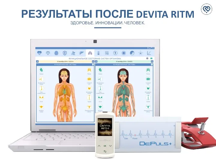 РЕЗУЛЬТАТЫ ПОСЛЕ DEVITA RITM ЗДОРОВЬЕ. ИННОВАЦИИ. ЧЕЛОВЕК.