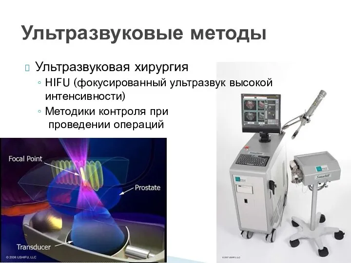 Ультразвуковая хирургия HIFU (фокусированный ультразвук высокой интенсивности) Методики контроля при проведении операций Ультразвуковые методы