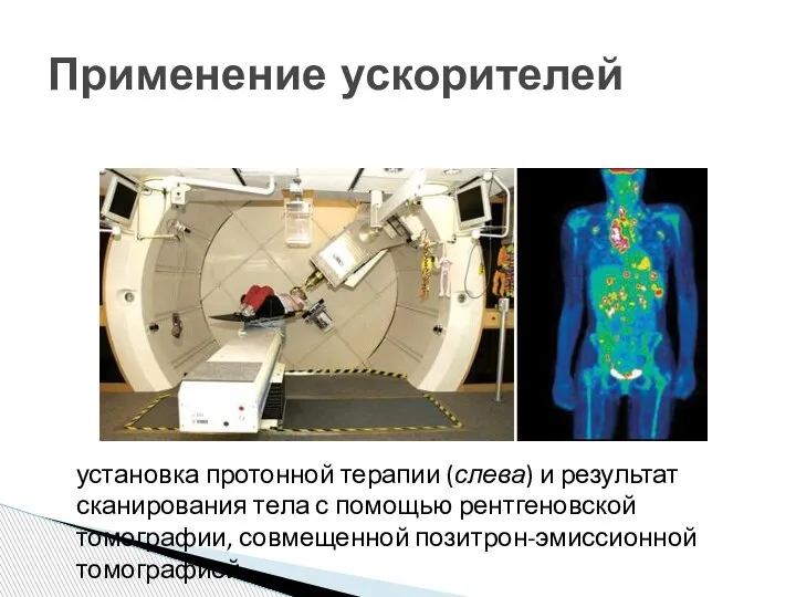 Применение ускорителей установка протонной терапии (слева) и результат сканирования тела с помощью