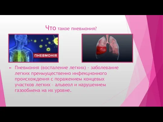 Что такое пневмония? Пневмония (воспаление легких) - заболевание легких преимущественно инфекционного происхождения