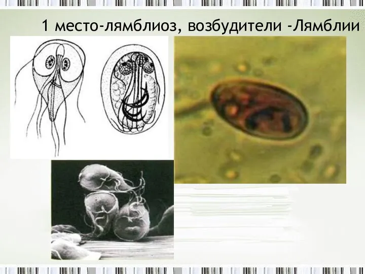 1 место-лямблиоз, возбудители -Лямблии