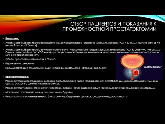 ОТБОР ПАЦИЕНТОВ И ПОКАЗАНИЯ К ПРОМЕЖНОСТНОЙ ПРОСТАТЭКТОМИИ Показания: Локализованный рак простаты низкого