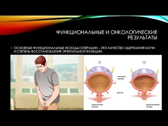 ФУНКЦИОНАЛЬНЫЕ И ОНКОЛОГИЧЕСКИЕ РЕЗУЛЬТАТЫ ОСНОВНЫЕ ФУНКЦИОНАЛЬНЫЕ ИСХОДЫ ОПЕРАЦИИ - ЭТО КАЧЕСТВО УДЕРЖАНИЯ