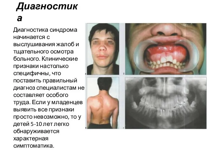 Диагностика Диагностика синдрома начинается с выслушивания жалоб и тщательного осмотра больного. Клинические