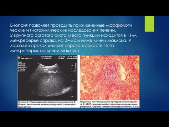 Биопсия позволяет проводить прижизненные морфологи­ческие и гистохимические исследования печени. У крупного рогатого