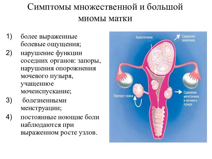 более выраженные болевые ощущения; нарушение функции соседних органов: запоры, нарушения опорожнения мочевого