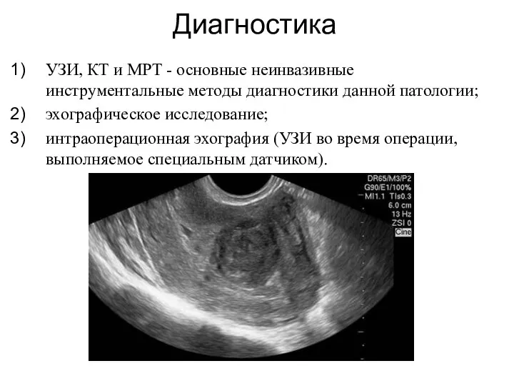 УЗИ, КТ и МРТ - основные неинвазивные инструментальные методы диагностики данной патологии;