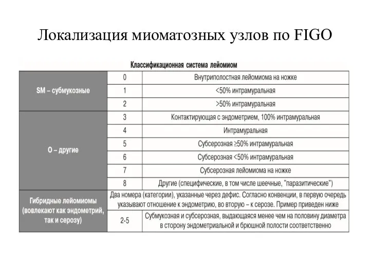 Локализация миоматозных узлов по FIGO