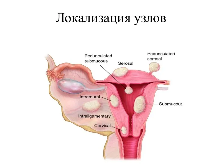 Локализация узлов