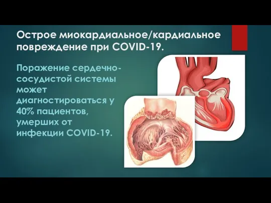 Острое миокардиальное/кардиальное повреждение при COVID-19. Поражение сердечно-сосудистой системы может диагностироваться у 40%