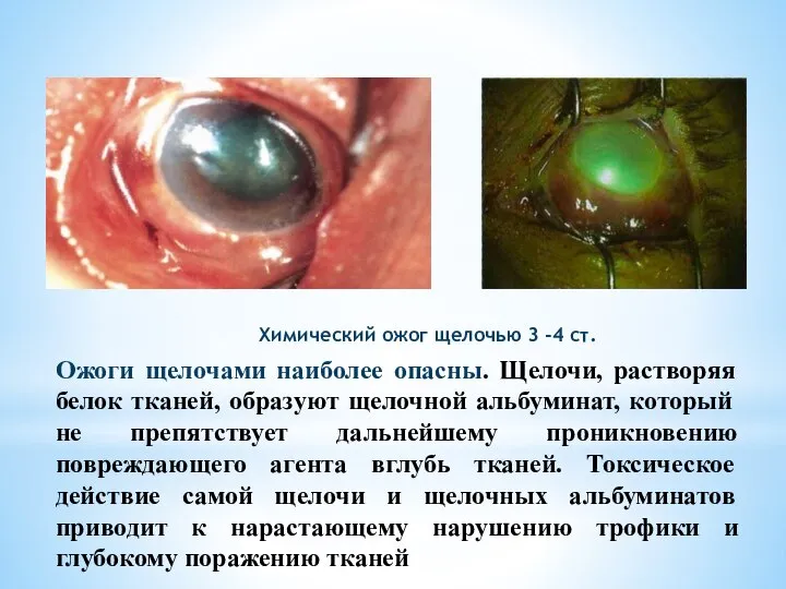 Ожоги щелочами наиболее опасны. Щелочи, растворяя белок тканей, образуют щелочной альбуминат, который