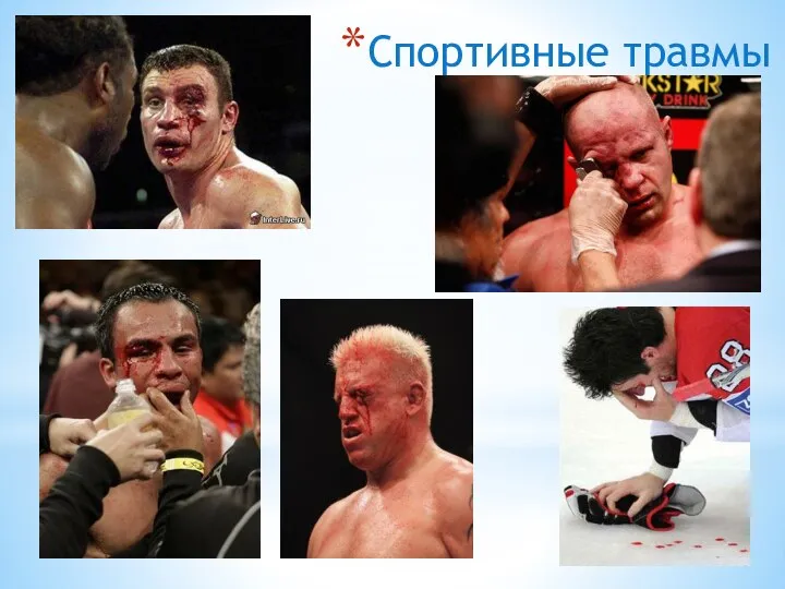 Спортивные травмы