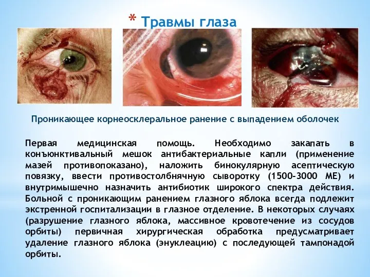 Травмы глаза Первая медицинская помощь. Необходимо закапать в конъюнктивальный мешок антибактериальные капли