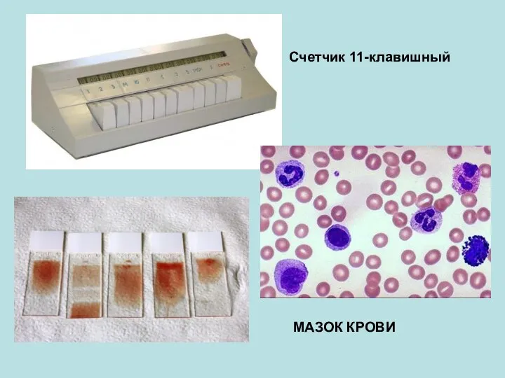 МАЗОК КРОВИ Счетчик 11-клавишный