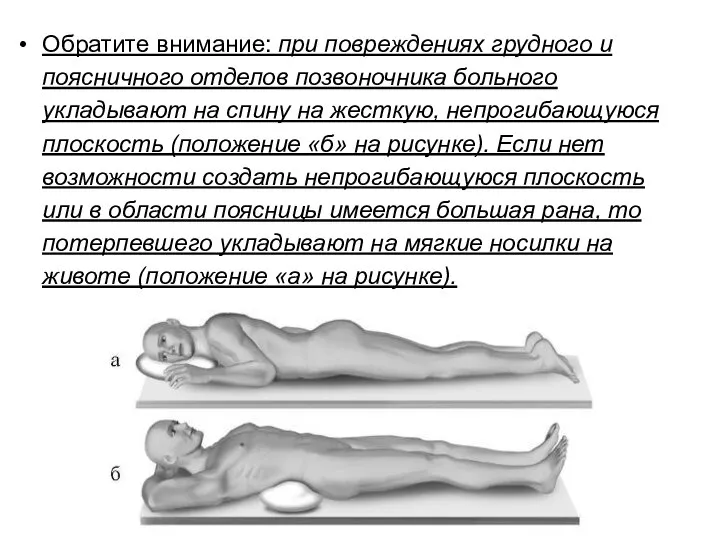 Обратите внимание: при повреждениях грудного и поясничного отделов позвоночника больного укладывают на